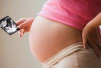 Ученые подсчитали, что за следующие два года Зико заболеет более 1,6млн. беременных