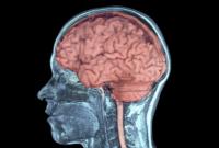 Биотехнологи начали эксперимент по регенерации мозга умерших людей