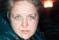 Жену украинского бойца зверски избили под Киевом