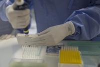 Вирус Зика: во Франции ограничили донорство крови