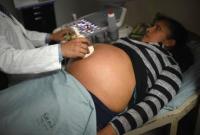 Более пяти тысяч беременных колумбиек заражены вирусом Зика