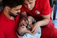 Сиамские близнецы в Сирии погибли в ожидании разрешения на операцию за рубежом