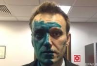 Навальный заявил, что может потерять глаз из-за ожога зеленкой и обвинил в этом инциденте Кремль