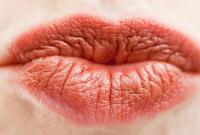 Медики определили, какие бактерии передаются через поцелуи