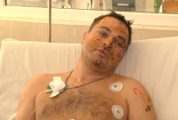 Один из подорвавшихся на мине под Мариуполем полицейских рассказал о теракте (видео)