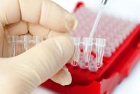 За неделю в Запорожье зафиксировано три случая заболевания вирусным гепатитом