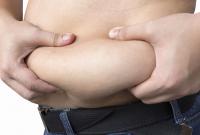 Медики назвали часть тела, где скапливается самый опасный вид жира