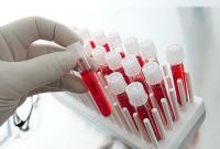 Новый анализ крови может обнаружить рак задолго до появления симптомов