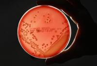 Бактерии стали более устойчивыми к антисептикам на основе спирта, - ученые
