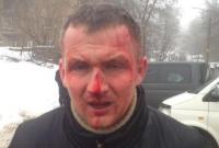 В Киеве жестоко избили нардепа