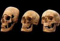 Ученые раскрыли секрет странных черепов средневековых европейских женщин (видео)