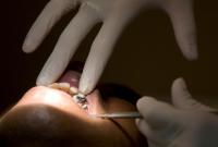Обнаружена смертельная опасность проблем с зубами