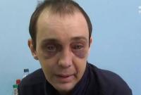 Сотрясение мозга и раздроблена челюсть: в Киевской области водитель маршрутки избил пассажира, который требовал сдачу