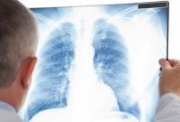 В Украине ежедневно умирают 10 больных туберкулезом