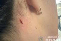 В Николаеве во время стрельб полицейских пострадала женщина