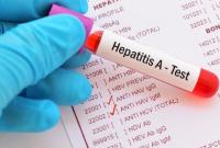Гепатит в Чернигове: заболели уже трое взрослых и 23 ребенка