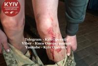 В Киеве нетрезвый военный прострелил ноги бойцу АТО