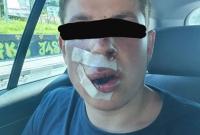 В Польше жестоко избили студента, когда он сказал, что из Украины