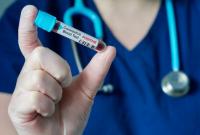 В Германии подтвердили уже седьмой случай коронавируса