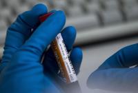 Украина получит 30 комплектов тест-систем на выявление нового коронавируса