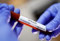 Разработанные Украиной тесты на коронавирус могут появится в следующий вторник
