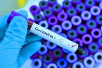 В Минздраве рассказали, сколько стоит тест-система для проверки на коронавирус