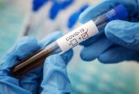 Рост числа больных COVID-19 на Херсонщине: за сутки выявлено восемь инфицированных