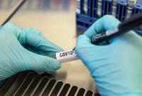 Канада проверила на коронавирус 14% своих жителей