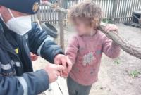 В Херсонской области 6-летняя девочка надела на палец шайбу и не смогла снять: вызвали спасателей