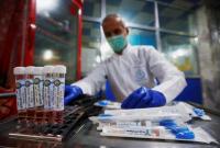 Сотня побічних реакцій, четверо померлих: у Франції розповіли про наслідки лікування хворих COVID-19 препаратами проти малярії та ВІЛ
