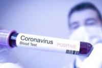 В Минздраве заявляют о проблеме с тестированием на коронавирус в Киевской области