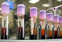 Науковці з Італії з'ясували ще одну руйнівну функцію коронавірусу