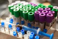 Ляшко заявив, що в Україні можуть запустити масове тестування на антитіла до коронавірусу