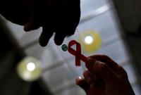 Науковці розробили новий препарат тривалої дії, який може лікувати ВІЛ