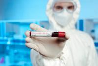 Во Львовской области обнаружили еще 68 инфицированных коронавирусом