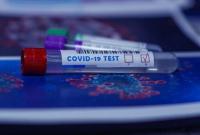 На Днепропетровщине уже почти 1 тыс. инфицированных COVID-19