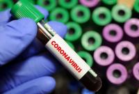 В Винницкой области за сутки коронавирус обнаружили у 29 человек