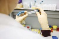 За сутки в Украине совершили более 8,9 тыс. ПЦР-тестов на коронавирус