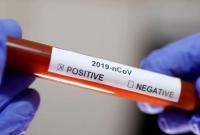 Во Франции новым коронавирусом заболело 377 человек, шестеро умерли