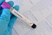 США вышли на третье место в мире по числу зараженных коронавирусом