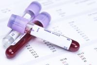В Британии начнут испытания анализа крови, выявляющего 50 типов рака