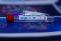 В Чехии больницы могут не справится с количеством больных COVID-19