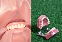 Чем грозит зубной треш-тренд из TikTok, а также что на этот счет думает стоматолог
