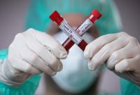 В Украине ожидается стремительный рост заболеваний коронавирусом