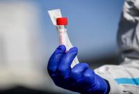 В Херсонской области зафиксировали 68 новых случаев коронавируса в сутки