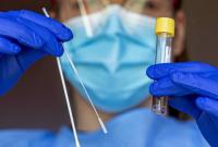 Украина до конца лета получит более 10 млн доз вакцин