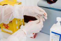 В Украине от COVID-19 сделали уже 24 млн прививок