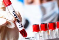 Исследования показали, что антитела защищают от повторного заражения COVID-19 на 83%