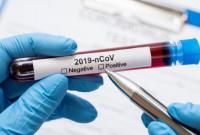 В Литве у медиков после COVID-вакцинации обнаружили коронавирус