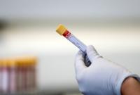В Болгарии обнаружили британскую мутацию коронавируса